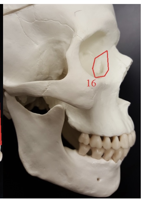 <p>16) name this bone </p>