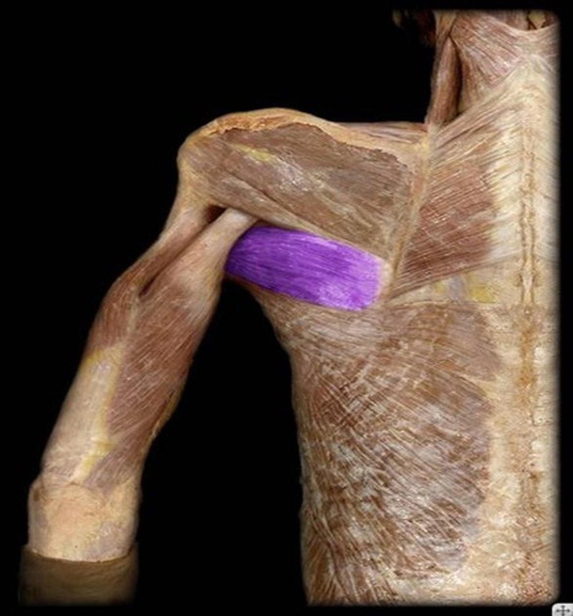 <p>What is the name of this muscle, highlighted in purple?</p>