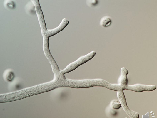 <p>is this hyphae septate or coenocytic</p>