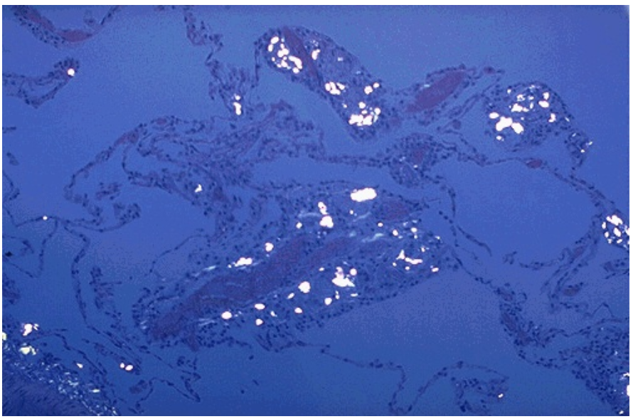 <ol><li><p>Identify</p></li><li><p>Identify the white crystals</p></li><li><p>What type of microscopy is used?</p></li></ol><p></p>