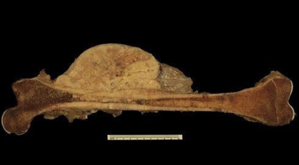 <p>Identify the <strong>organ</strong> and the <strong>diagnosis</strong> in this format: <em>diagnosis, organ</em></p>