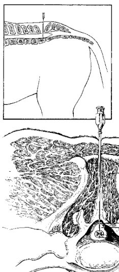 <p>Site of Cerebrospinal Puncture</p><ul><li><p><span style="background-color: transparent; font-family: "Times New Roman", serif;"><span>Sedate (standing) horse&nbsp;</span></span></p></li></ul><ul><li><p><span style="background-color: transparent; font-family: "Times New Roman", serif;"><span>Base of spine</span></span></p></li><li><p><span style="background-color: transparent; font-family: "Times New Roman", serif;"><span>Below foramen magnum</span></span></p></li></ul><p></p>