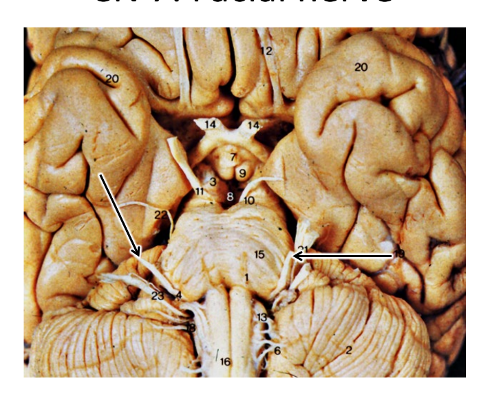 <p>what are the arrows pointing at</p>