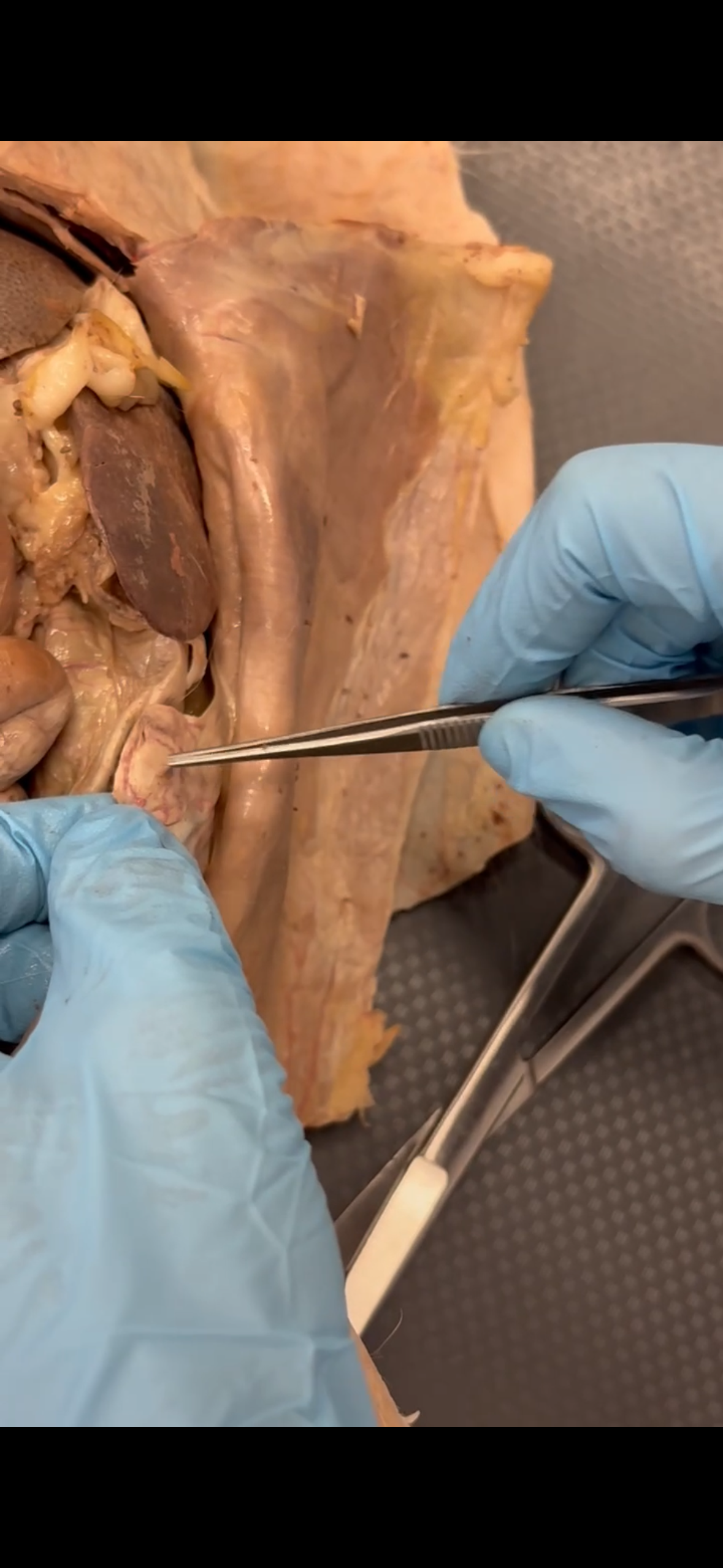 <p>Pointer points to which structure? </p>