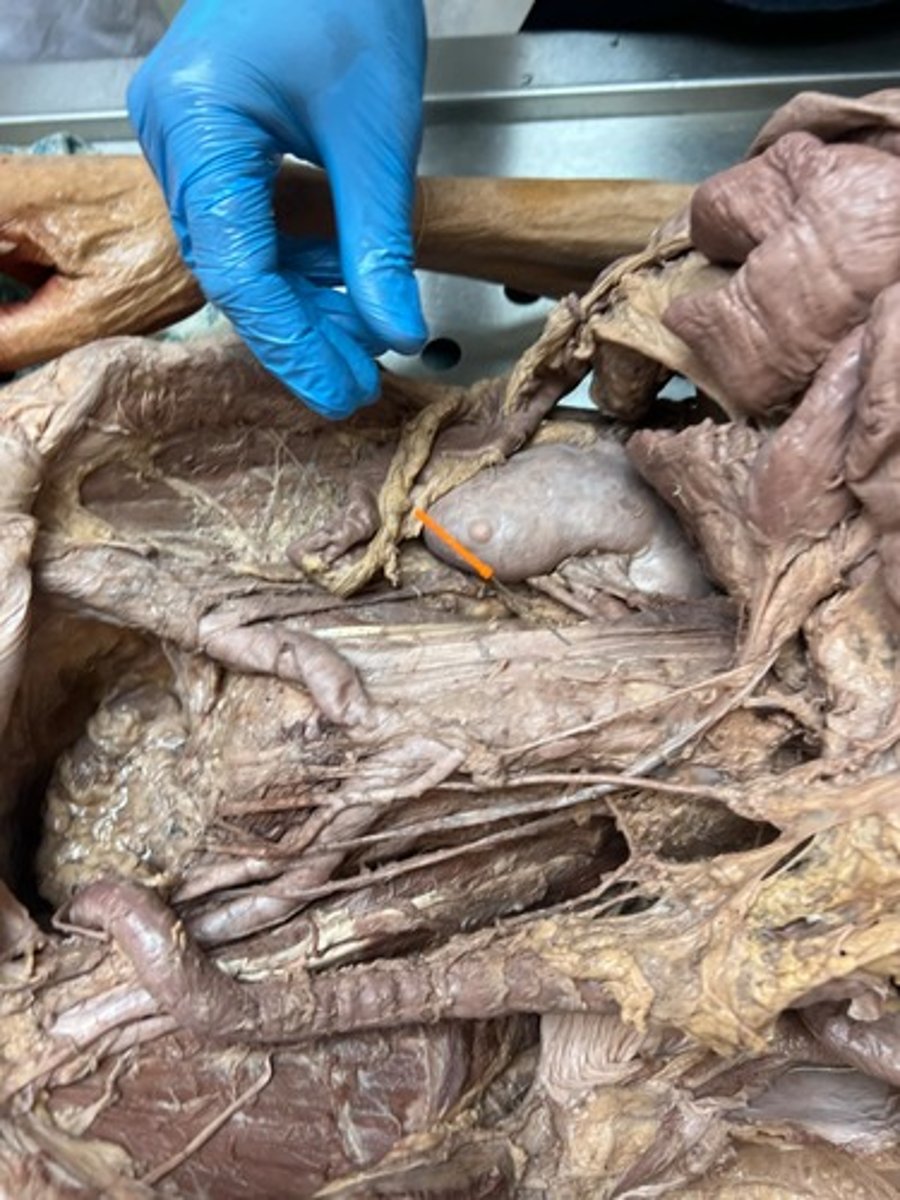 <p>inferior vena cava</p>