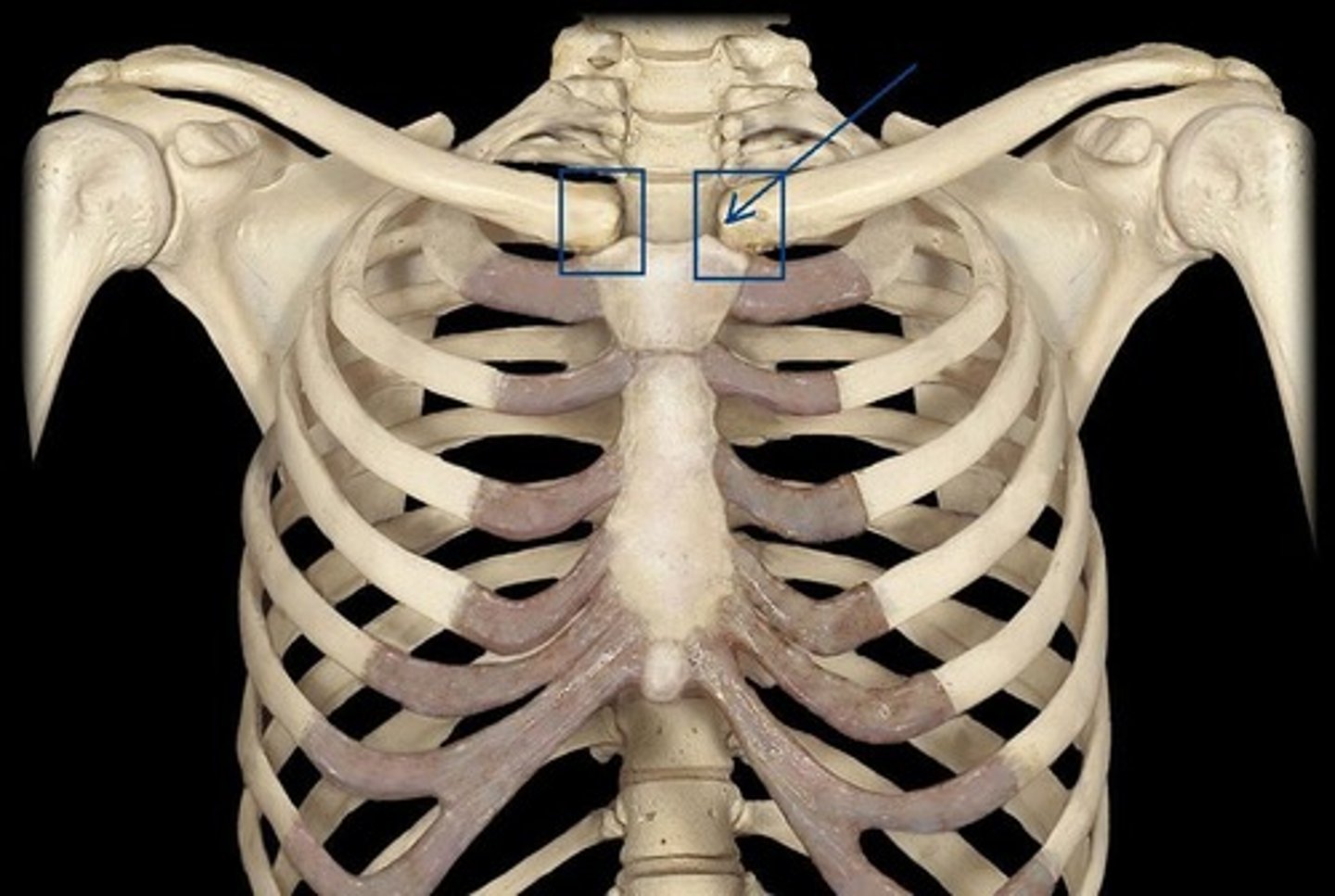 <p>what is it pointing to? diarthrodial, and plane (gliding)</p>
