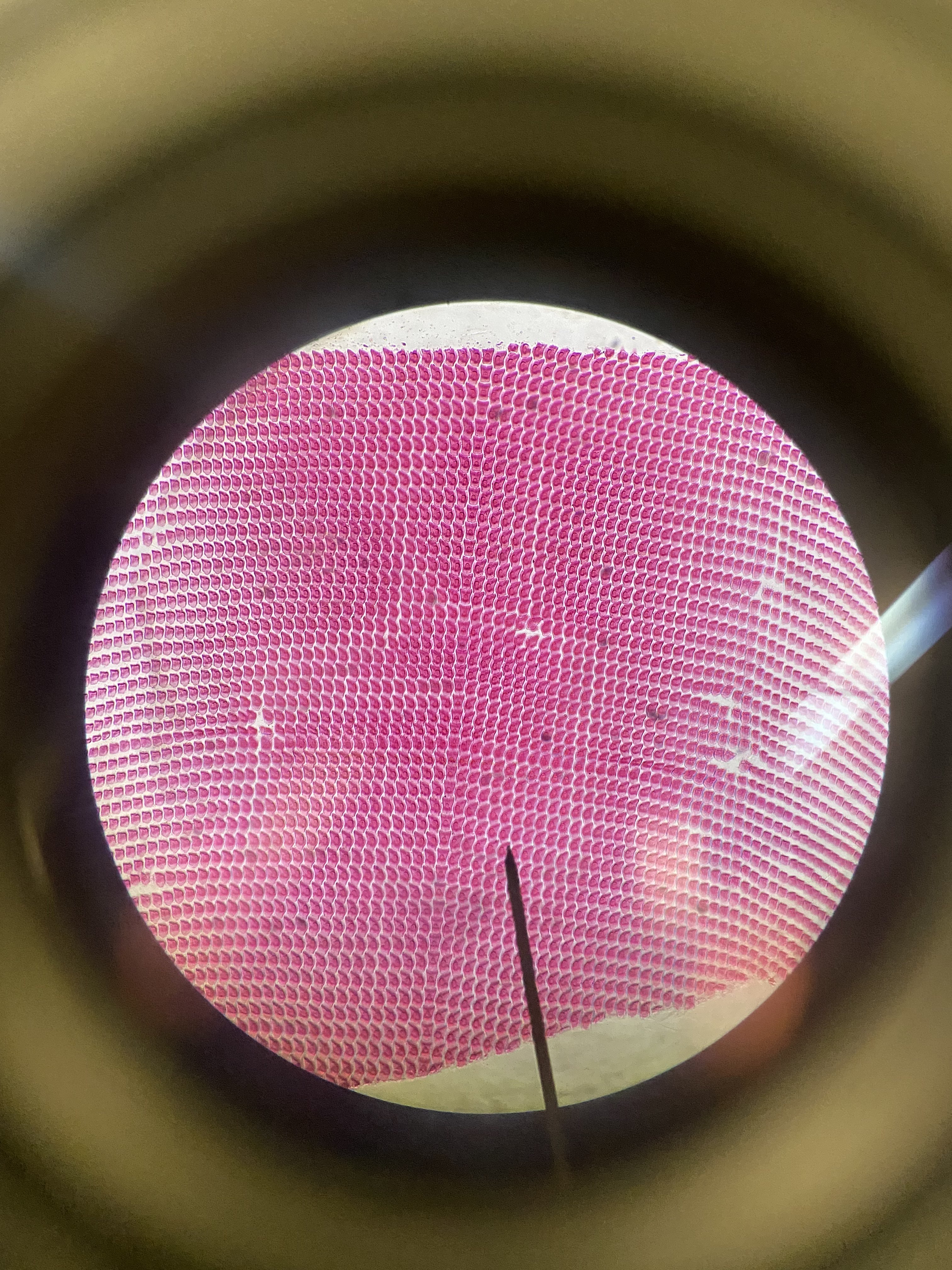 What is this a microscopic view of?