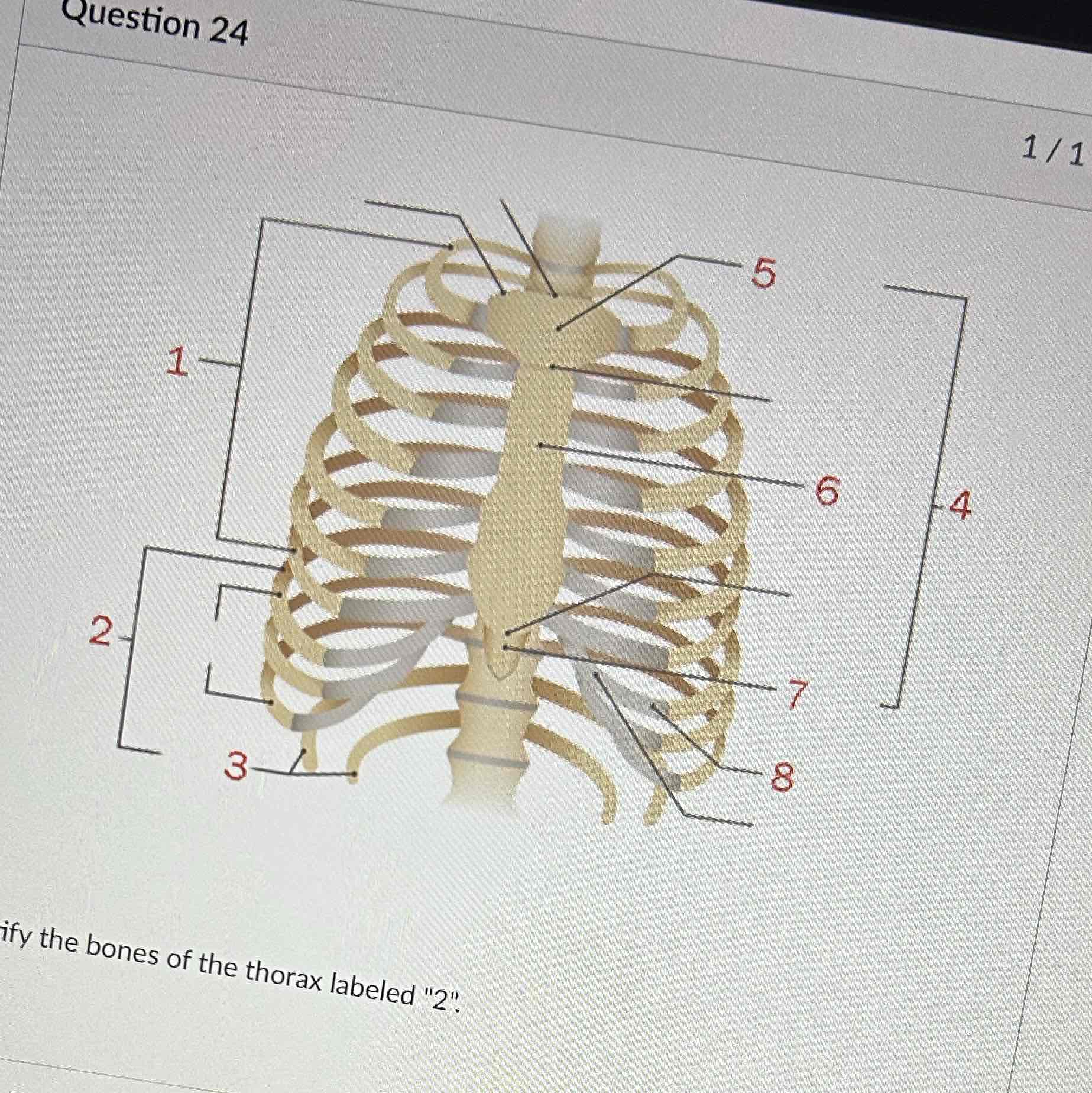 <p>Identify the bones of the thorax labeled “2”</p>