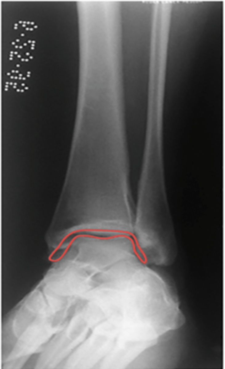 <p>What structure is highlighted?</p>