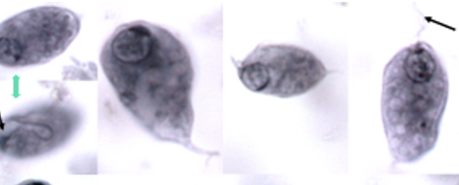 <p>Name: Chilomastix mesnili</p><p class="p1">Stage: trophozoite</p><p class="p1">(lemon shaped organisms with a single nucleus<span> & flagellum)</span></p>