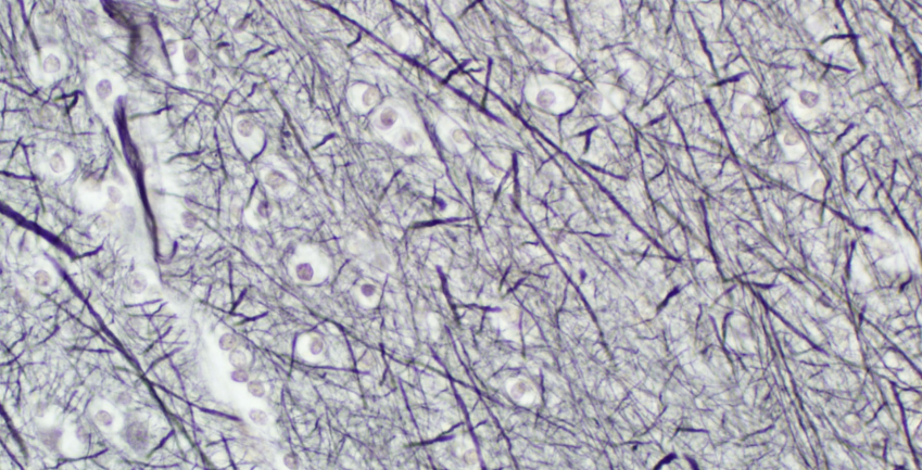 <p>Special stain for neurofibril/ Nerve fibers</p>