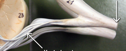 <p>right most arrow </p>