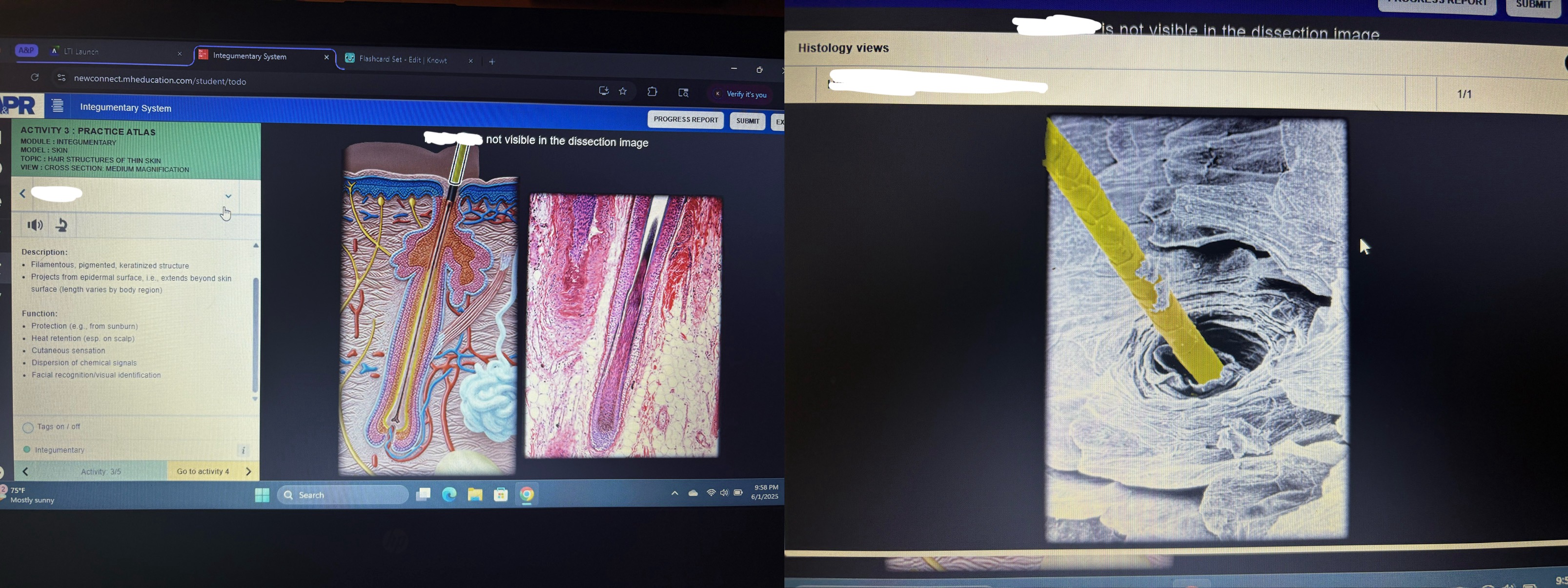 <p>Location- surface of epidermis</p><p>Function- protection (ex from sunburn), heat retention, cutaneous sensation, dispersion of chemical signals, facial recognition/visual identification</p>