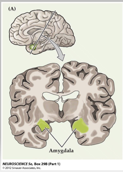 <p><span style="color: #ffffff">Amygdala: missing piece of the emotional puzzle (for papez)</span></p><p><span style="color: #ffffff"><br></span><span style="color: #ffffff">• Found in the temporal lobe –</span><span style="color: #ffffff"><br></span><span style="color: #ffffff">adjacent to hippocampus</span><span style="color: #ffffff"><br></span><span style="color: #ffffff">• Responsible for relating</span><span style="color: #ffffff"><br></span><span style="color: #ffffff">sensory stimuli with emotional</span><span style="color: #ffffff"><br></span><span style="color: #ffffff">experience</span><span style="color: #ffffff"><br></span><span style="color: #ffffff">• Site of associative learning</span><span style="color: #ffffff"><br></span><span style="color: #ffffff">• Connections with cortex,</span><span style="color: #ffffff"><br></span><span style="color: #ffffff">hippocampus, hypothalamus,</span><span style="color: #ffffff"><br></span><span style="color: #ffffff">thalamus, basal ganglia</span></p><p><span style="color: #ffffff"><br></span></p>