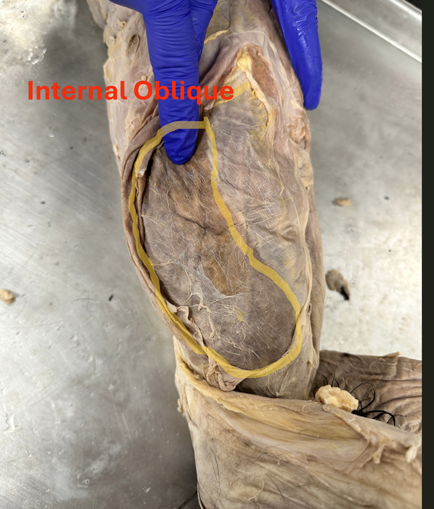 <p>Internal oblique (abdominal muscles)</p>