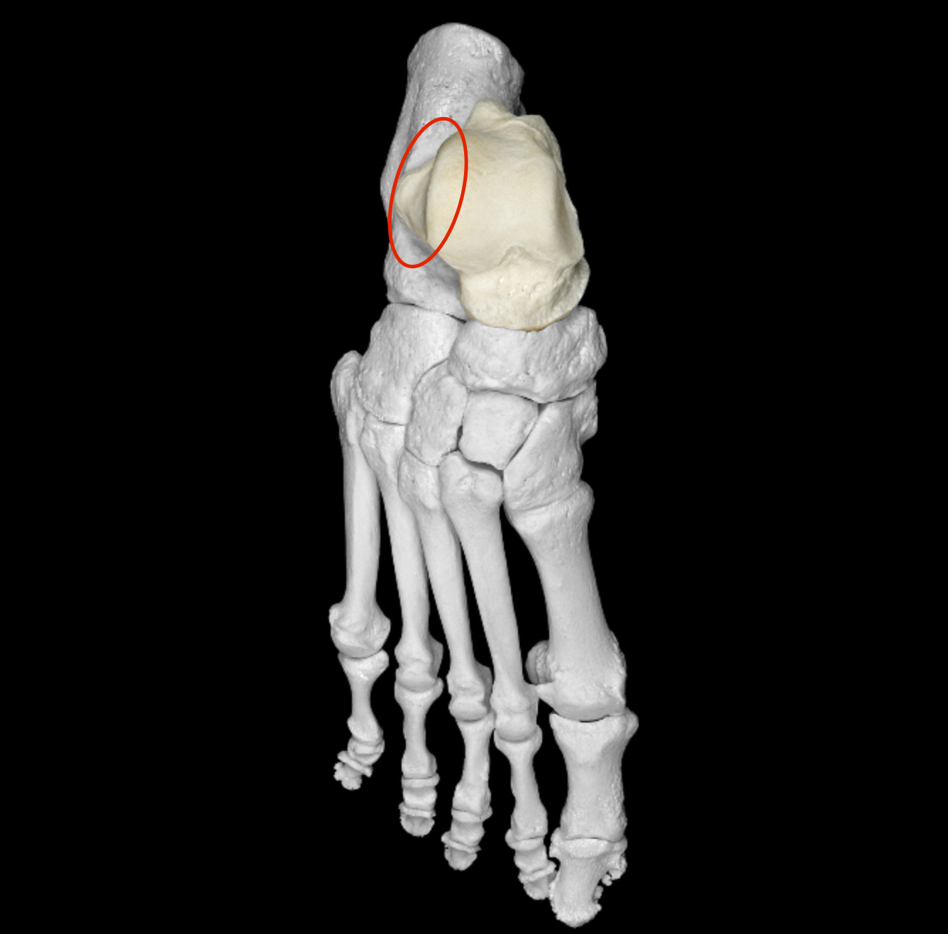 <p>lateral side of trochlea </p>