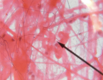 <p>what kind of tissue is this </p>