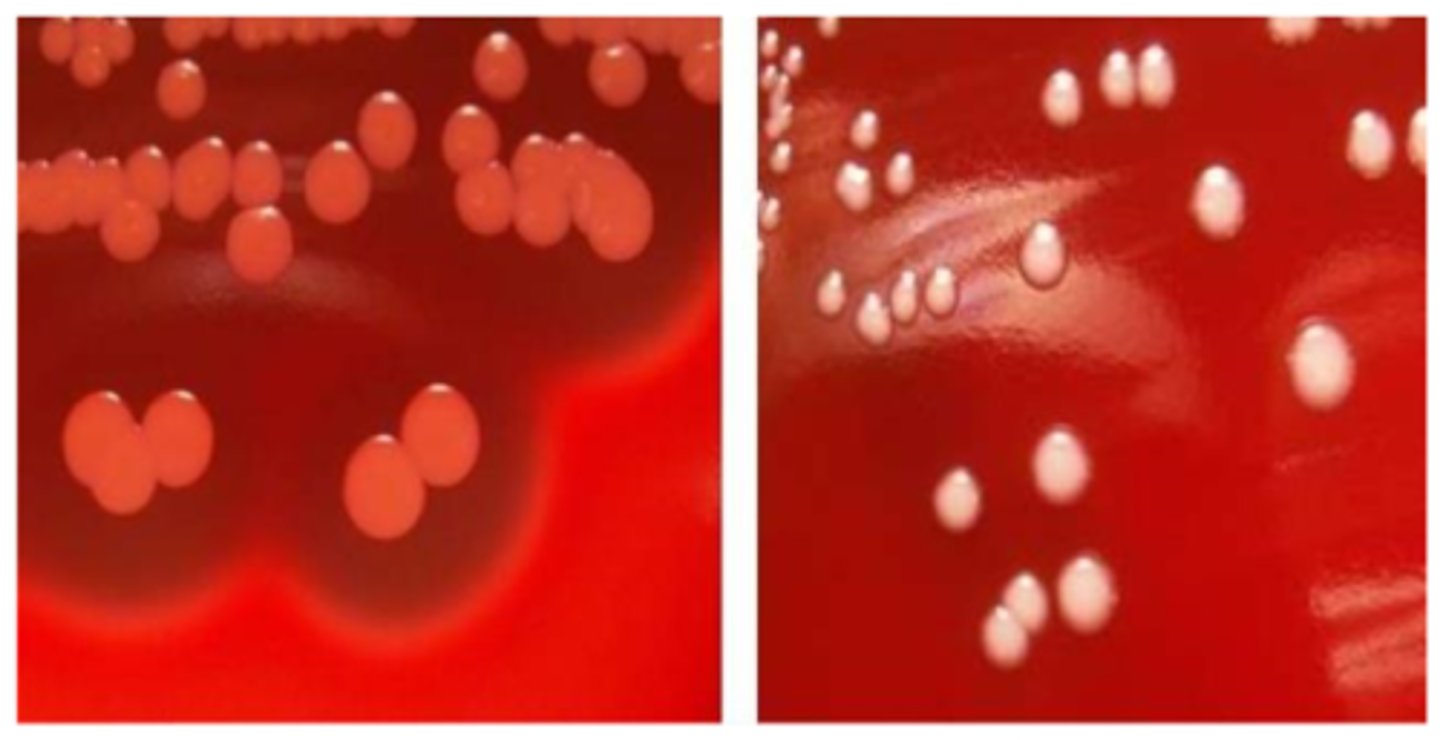 <p>-non-hemolytic</p><p>-white pigment (S. lugdunensis is "yellow")</p><p>-mid-large colony</p><p>-cocci in clusters </p>