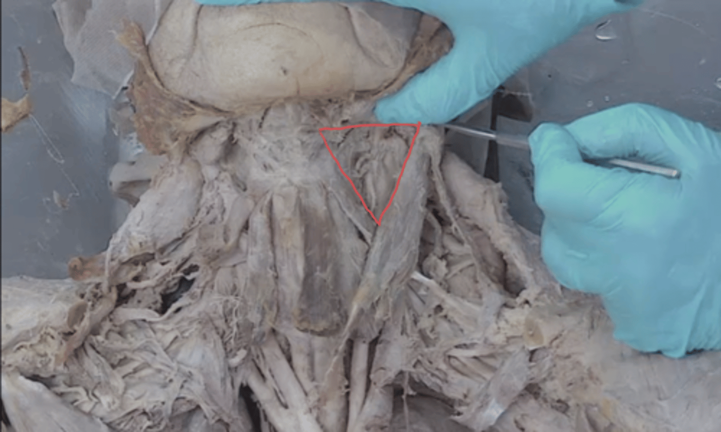 <p>identify this triangle</p>