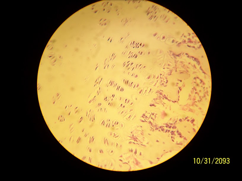 <p>White Fibrous Tissue (Fibrocartilage)</p>