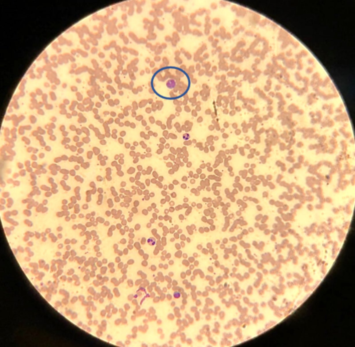 <p>What is the white blood cell being shown?</p>