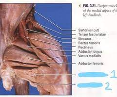 <p>Origin: Pubis</p><p>Insertion: Femur</p><p>Action: Adducts Thigh</p>