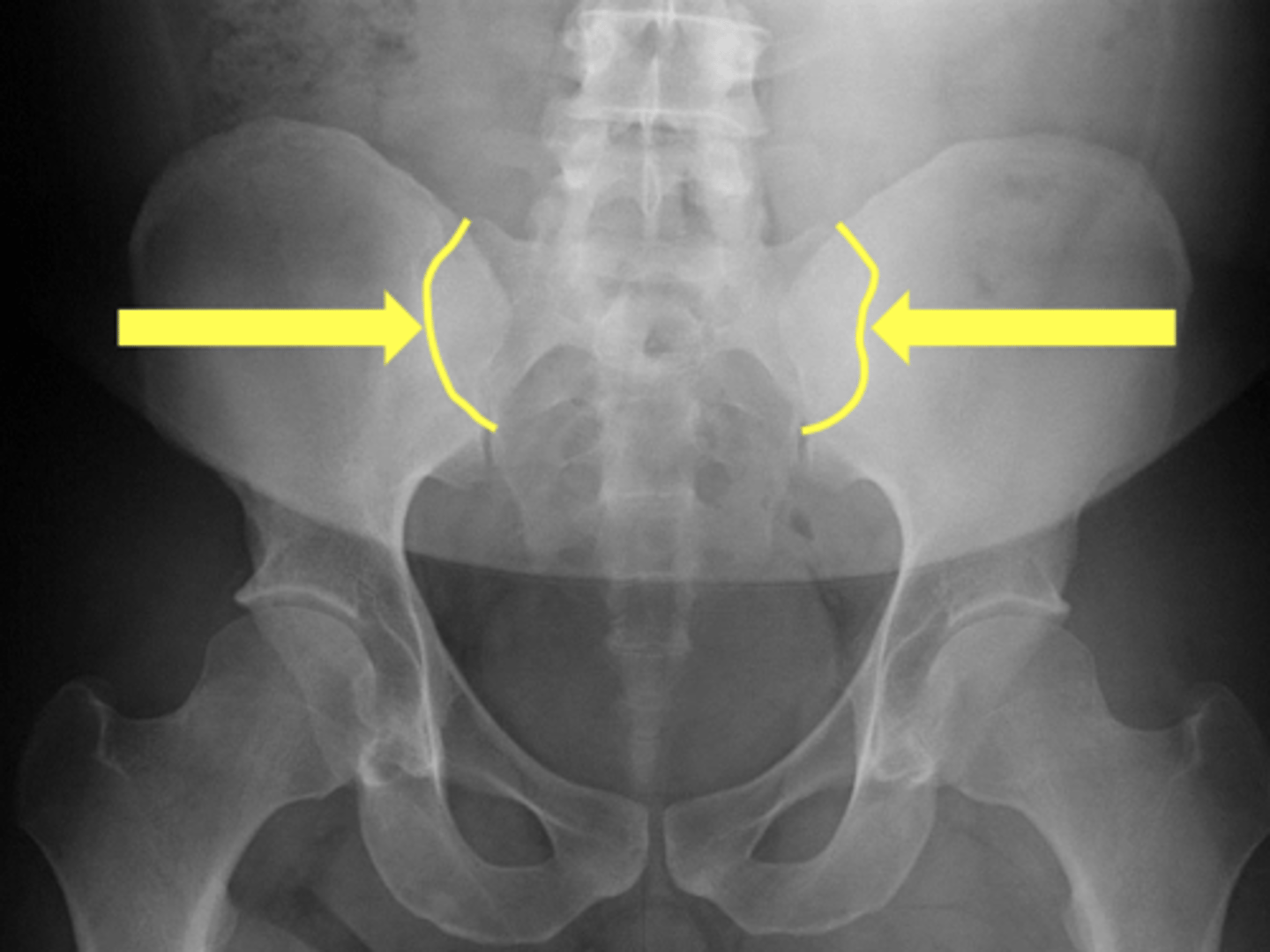 <p>What are the yellow arrows pointing to?</p>