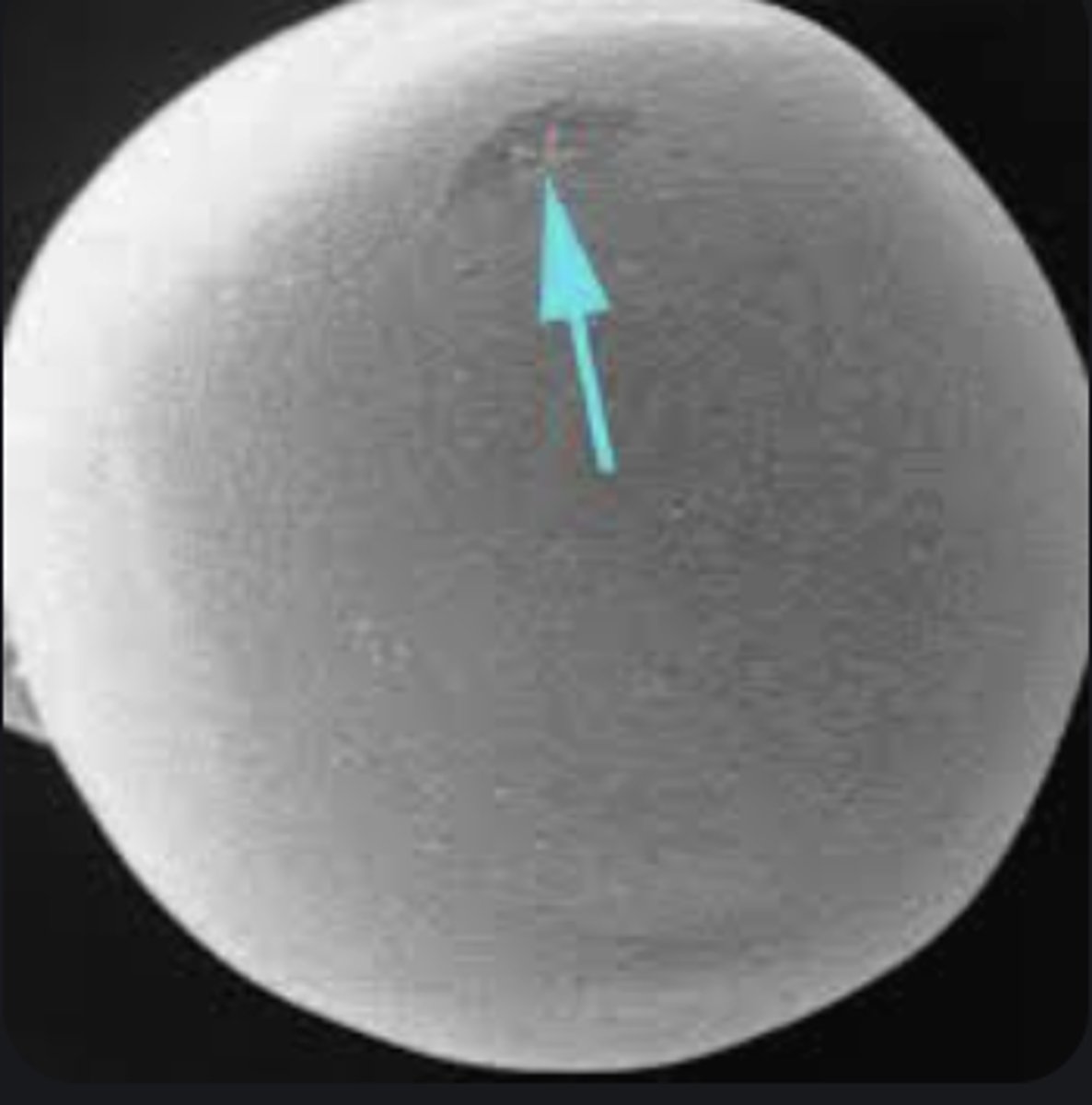 <p>Tiny opening in egg allowing sperm entry for fertilization.</p>