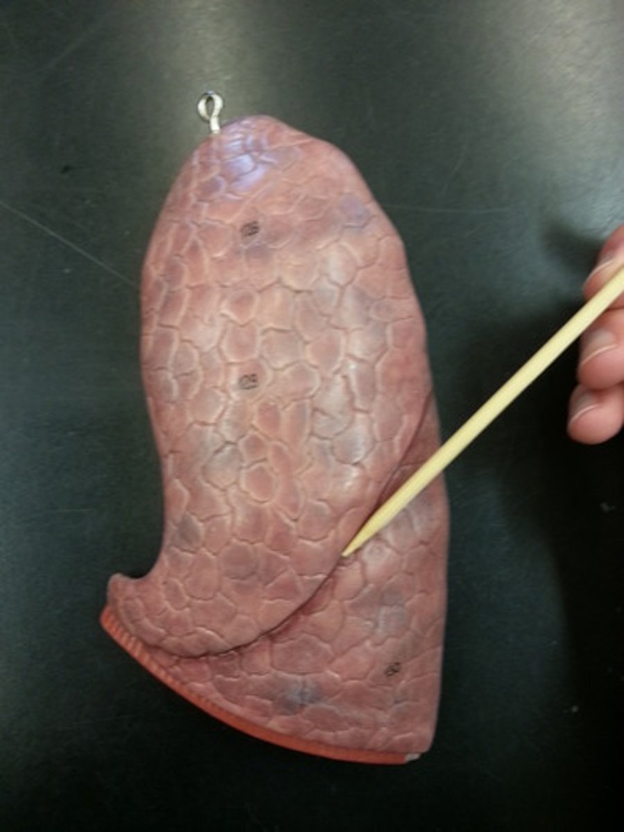 <p>2 lobes:</p><p>-superior</p><p>-inferior</p>