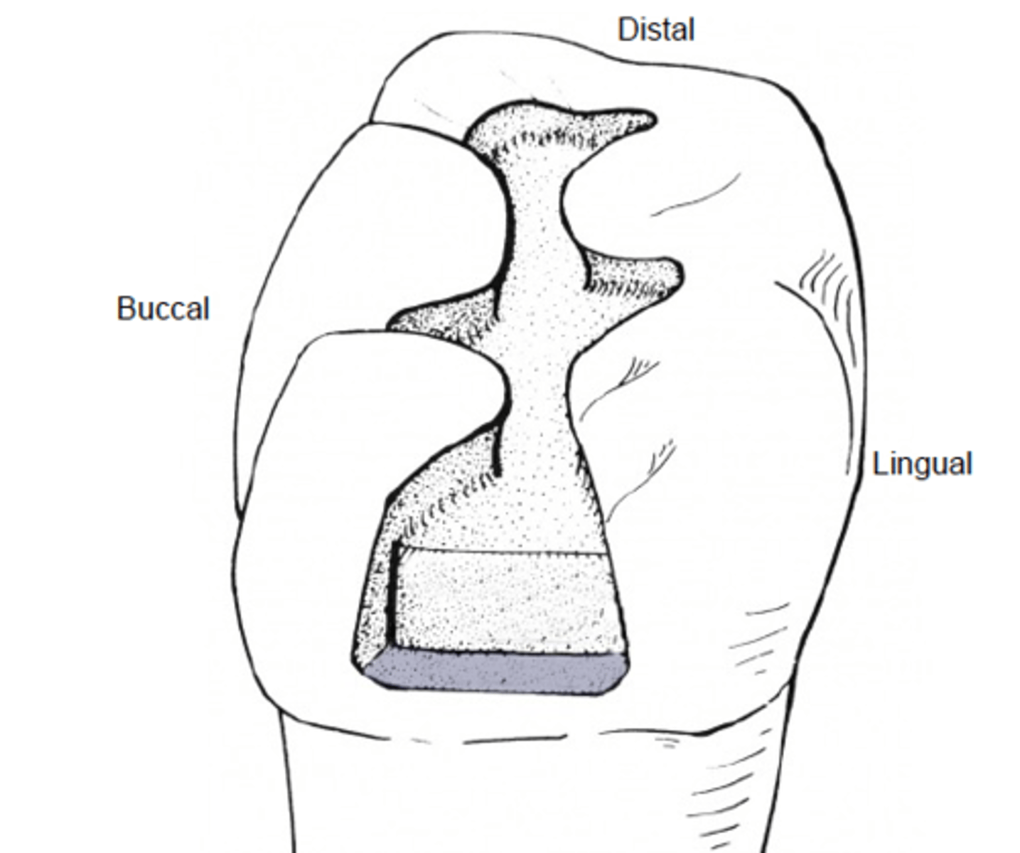 <p>smooth</p><p>marginal ridges</p><p>external contour of tooth</p>