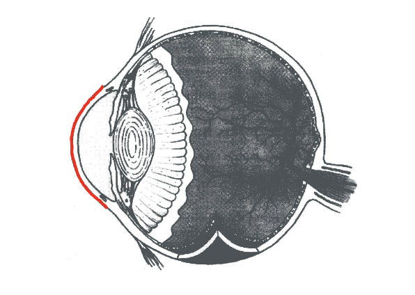 term image