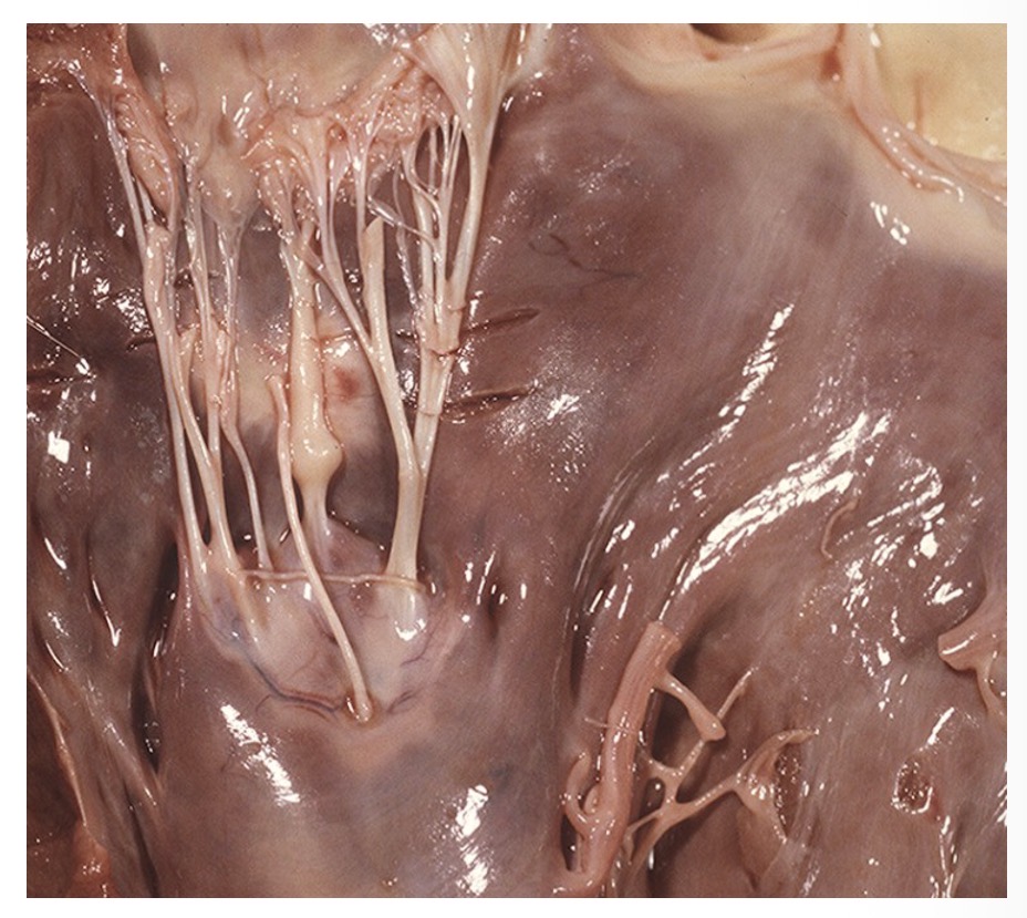<p>mitral > tricuspid > aortic > pul</p>