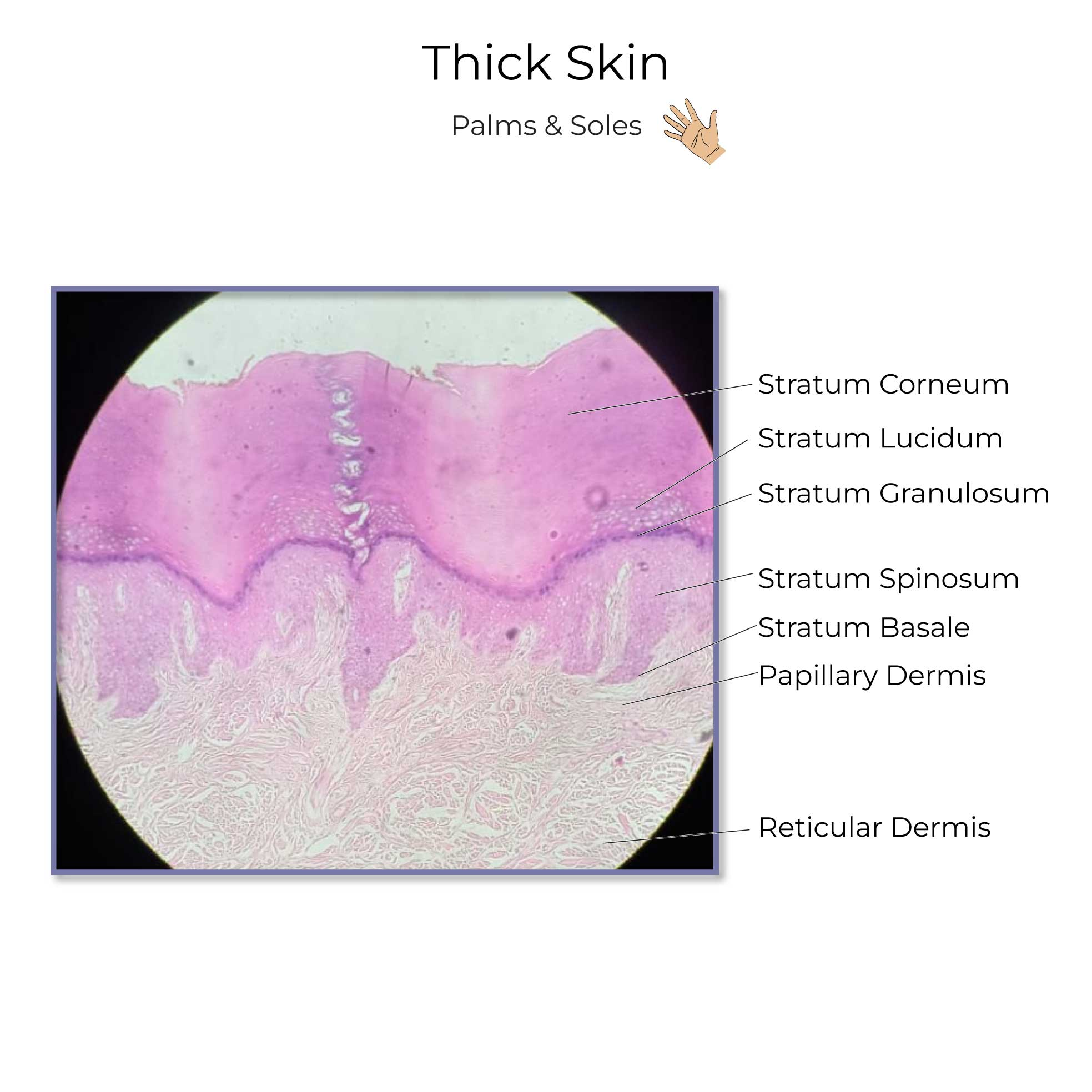 <p>c) Stratum lucidum</p>