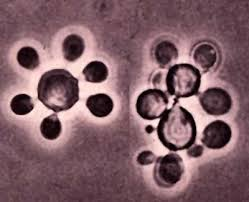 <p>BRASILIENSIS</p><p>BRAZIL, ARGENTINA, S.MEXICO</p><p></p>