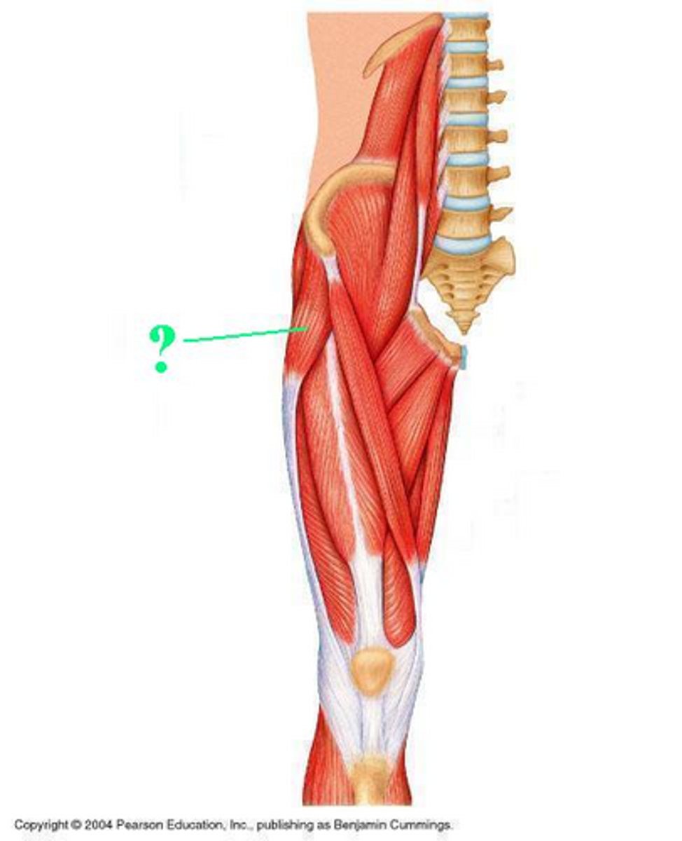 <p>Identify the indicated muscle</p>