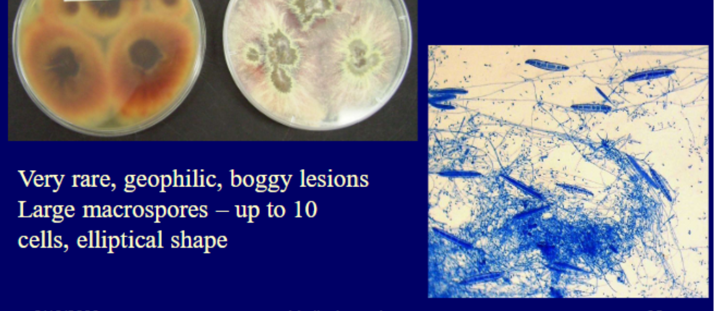 <p>Micro: thick cell walled macroconidia</p><p>Macro: white-yellow-beige obverse, deep purplish red reverse</p>