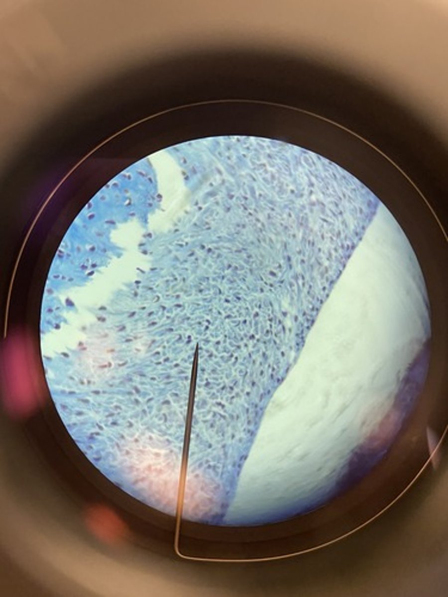 <p>A defining characteristic of cartilage</p>
