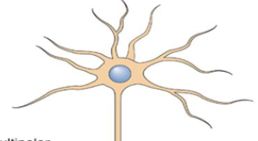 <p>What is this classified as and why?</p>