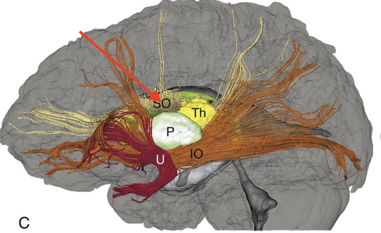 <p>connects the frontal and occipital lobes</p>