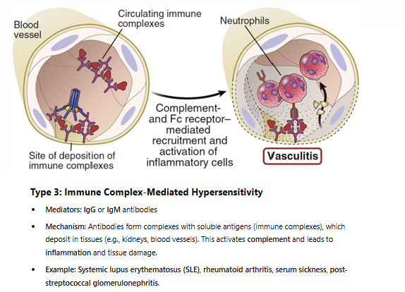 <p><span style="color: yellow">TLDR: Immune complex = IgG + IgM ABs deposited in tissue → impaired clearing + deposition → causes inflammation + tissue injury</span></p><p><br>Immune complexes (clusters of AB)<br>- bigger, heavier, larger = harder for us to eliminate<br>- deposit in our small blood vessels<br><span style="color: yellow"><strong>- start recruiting complement system</strong></span> (recruit neutrophil/macrophage) later on<br><span style="color: #10ff00">- we can’t clear fast enough → damage surrounding tissue</span><br>- leads to cell destruction</p><p>= vasculitis (inflammation of blood vessels)</p><p></p>