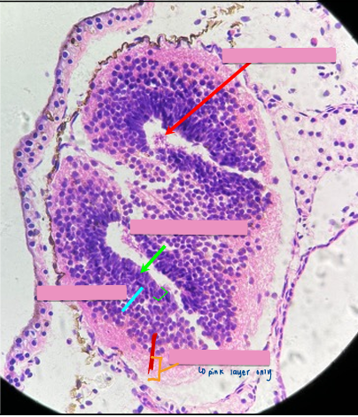 <p>what level<br>primary brain vesicle<br>parts</p>