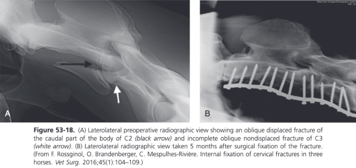 <ul><li><p><span>Fusion of the fractured vertebrae and possibly the next adjacent caudal vertebra is attempted</span></p></li><li><p><span>Following partial removal of the ventral spine of the body of each affected vertebrae, the disc material must be removed, at least partially, by drilling multiple holes with a 5.5 mm drill bit under radiographic guidance or using curettes</span></p></li><li><p><span>In fractures that extend over two vertebrae, transarticular cortex screws are inserted in lag fashion through the plate</span></p></li><li><p><span>Remaining holes filled with LHS</span></p></li></ul>