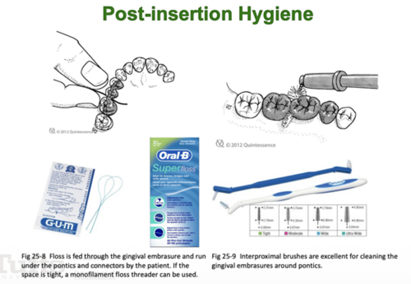 <p>- Floss through the gingival embrasures</p><p>- Monofilament floss threader</p><p>- Interproximal brushes</p>