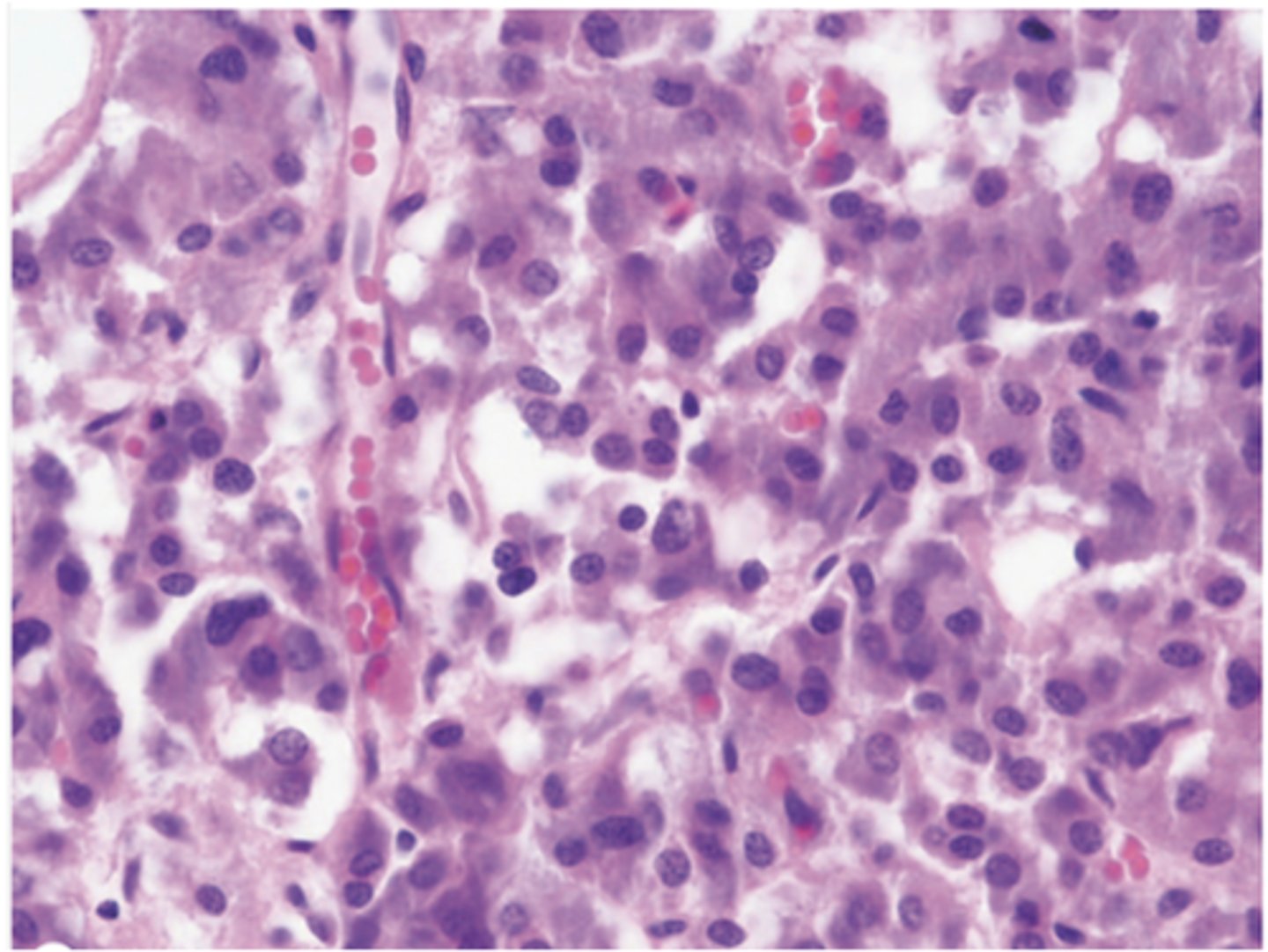 <p>What type of supporting tissue is found in the adrenal medulla?</p>