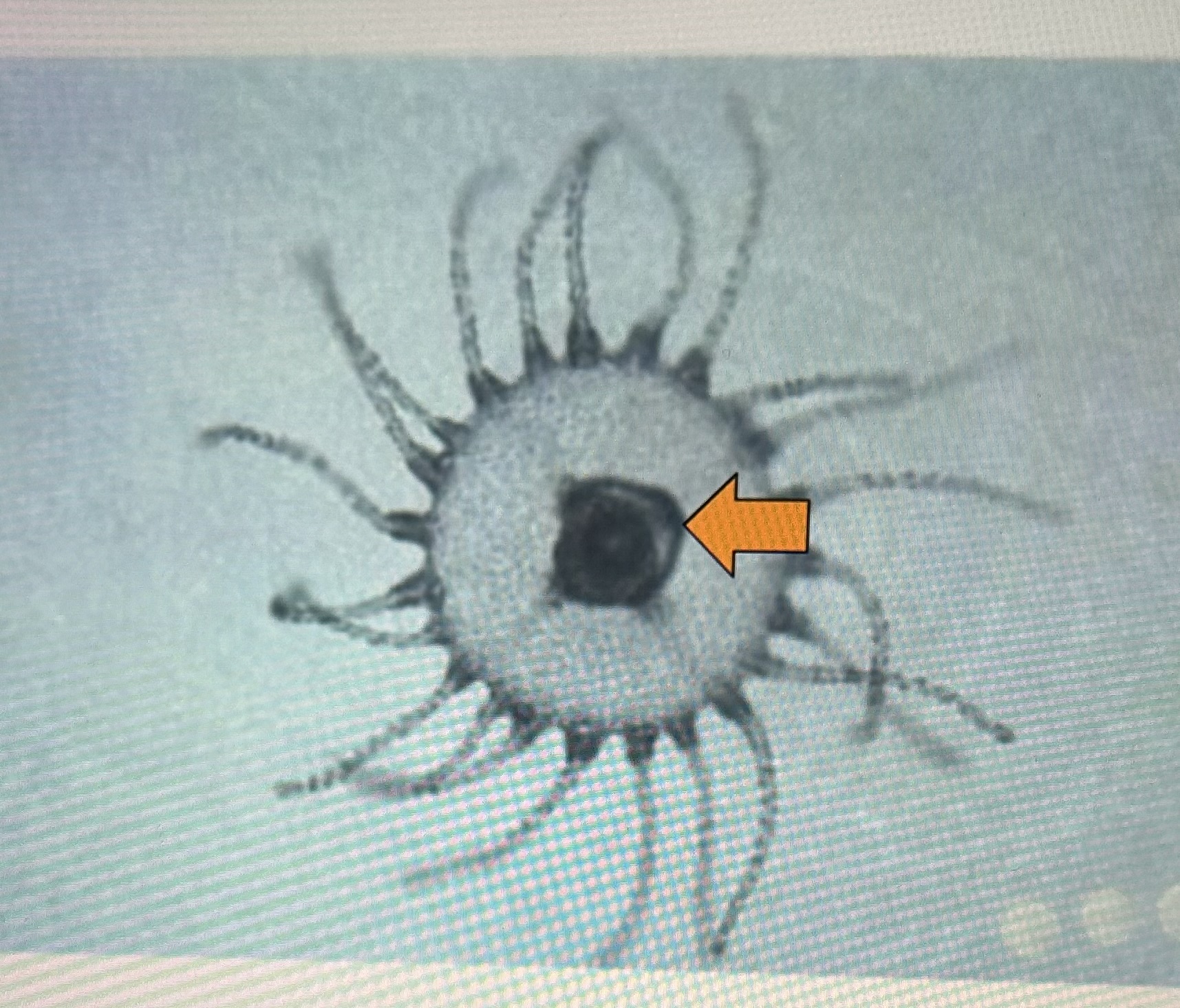 <p>What’s the arrow pointing at</p>