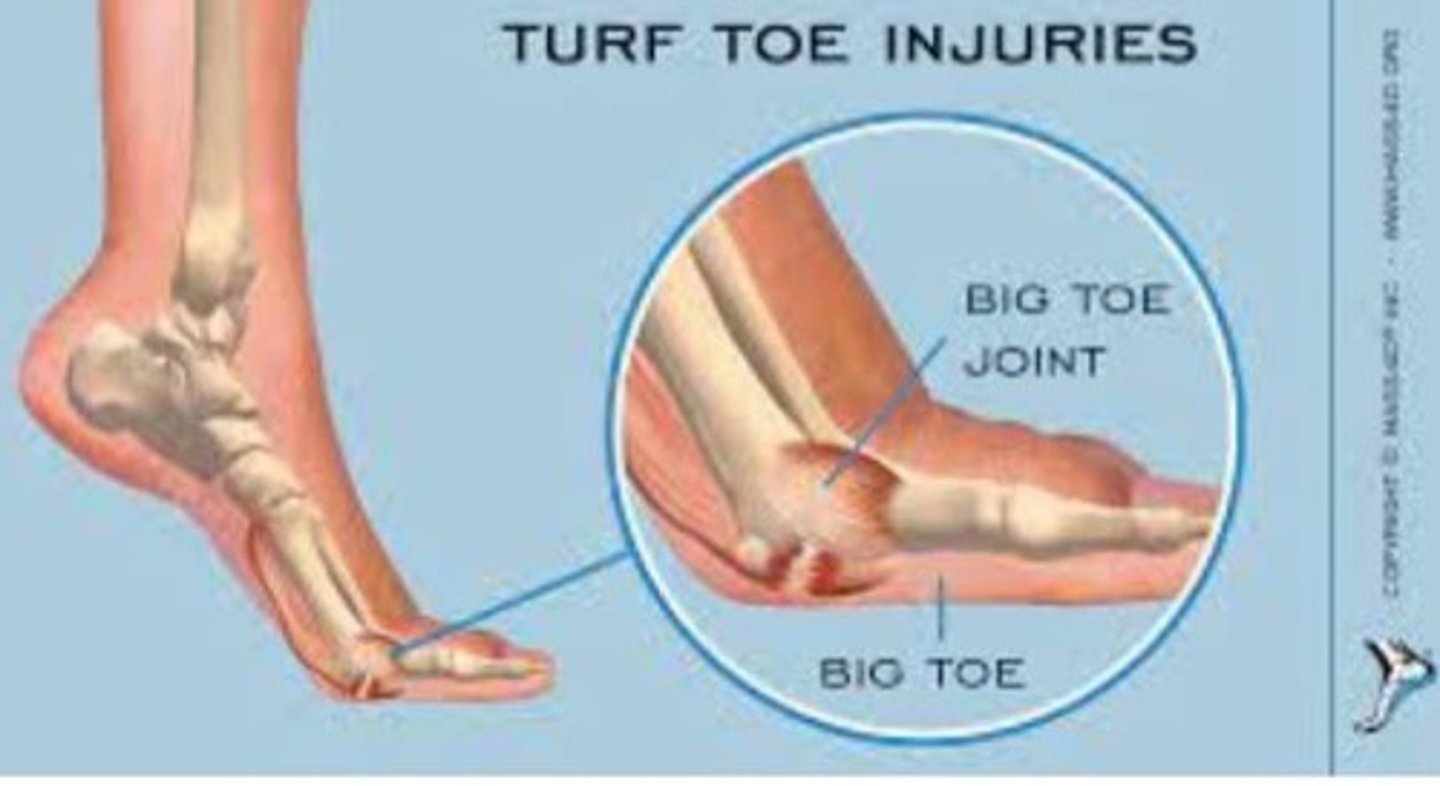 <p>Helps kick a ball, push off phase balance.</p>