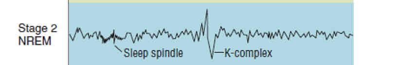 <p>when brain waves slow down in Stage 2 of NREM, short burst of activity come out </p><p>sudden,sharp waveforms appear</p>