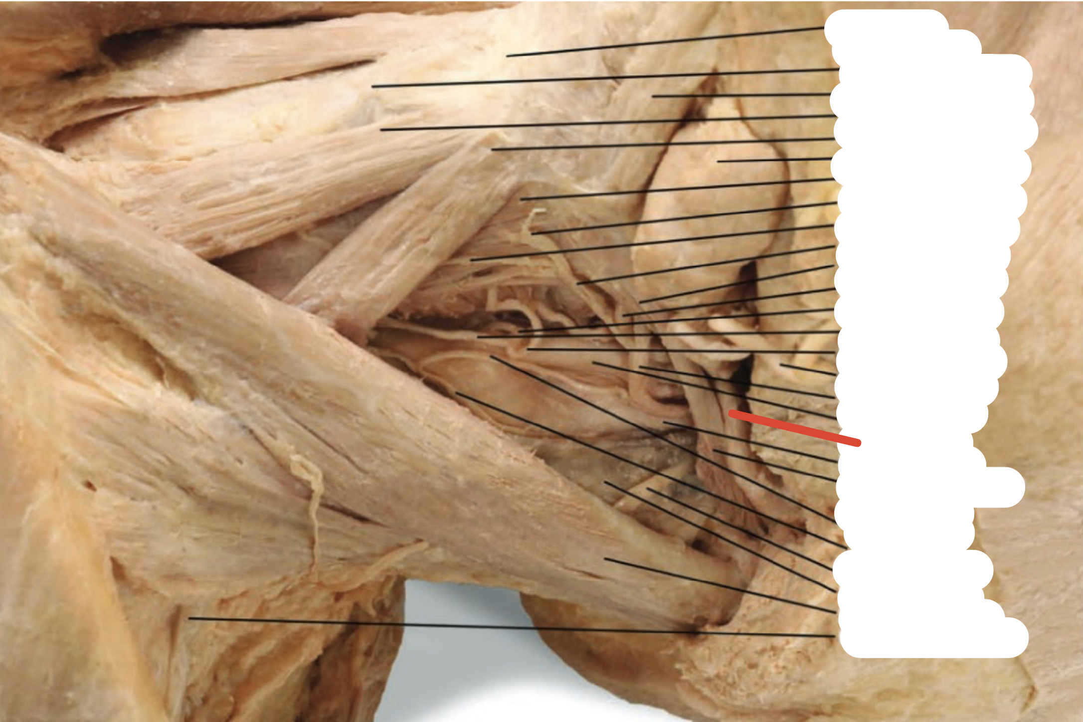 Identify the structure (red line)