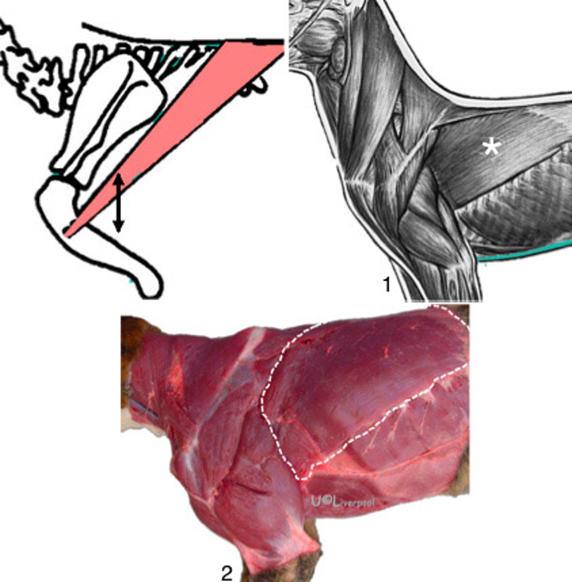 <p>What muscle is presented in this image?</p>