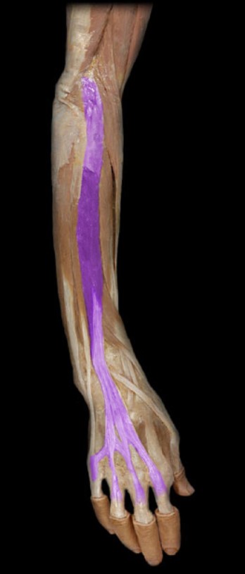 <p>Name the muscle highlighted (two words - all lowercase)</p>